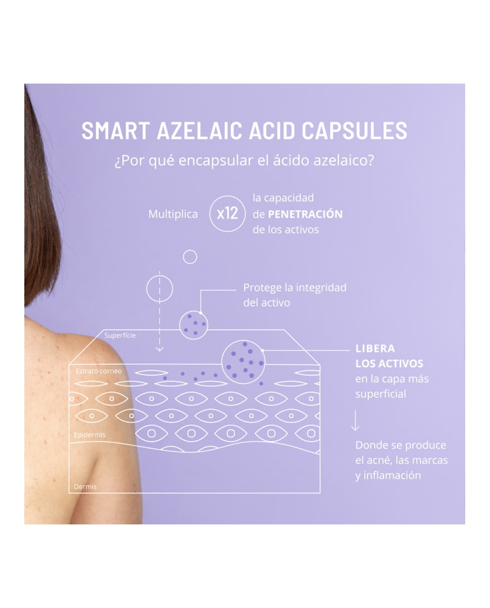 Gel Azelaic Active Body Treatment Freshly Cosmetics - 100 ml 7