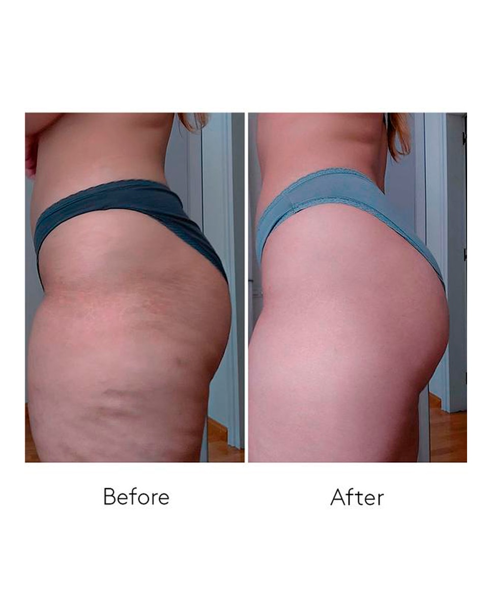 Dúo Anticelulitico Body Power Cocunat 6