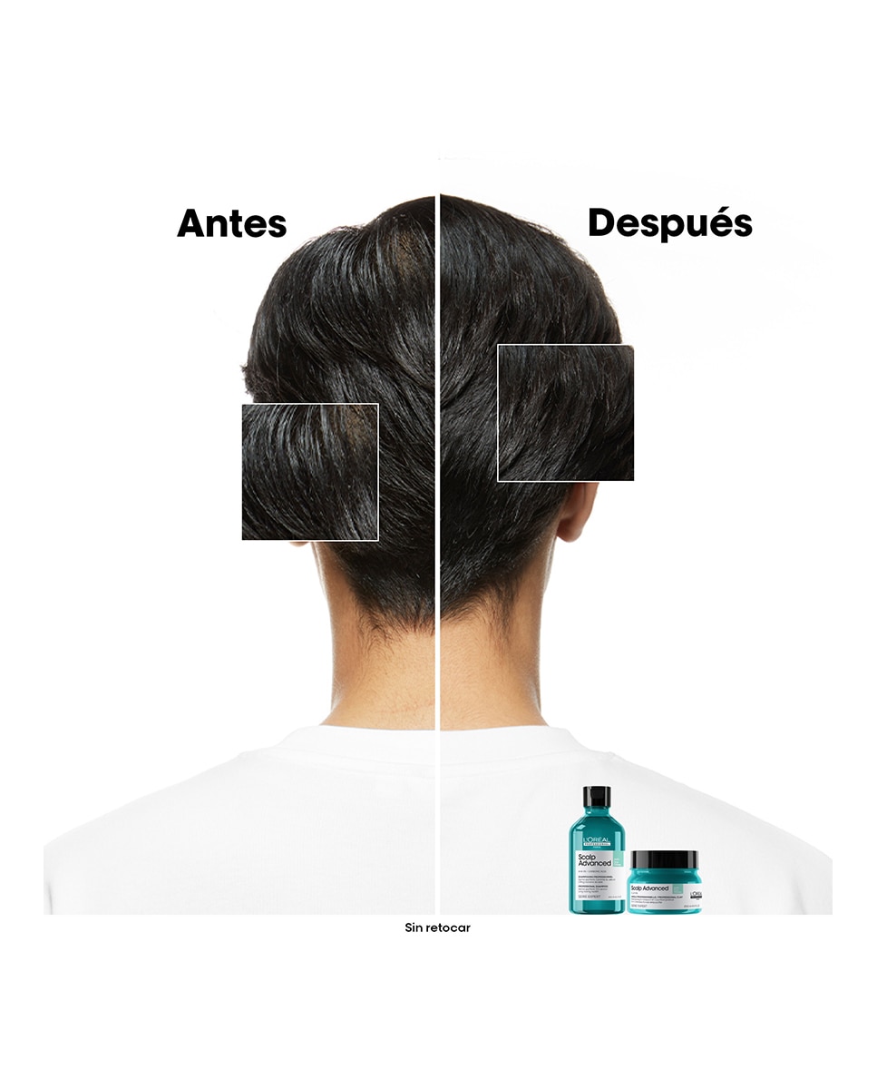 Champú anti grasa enriquecido Pelo graso Scalp Advanced Serie Expert 300 ml L'Oréal Professionnel - 300 ml 3