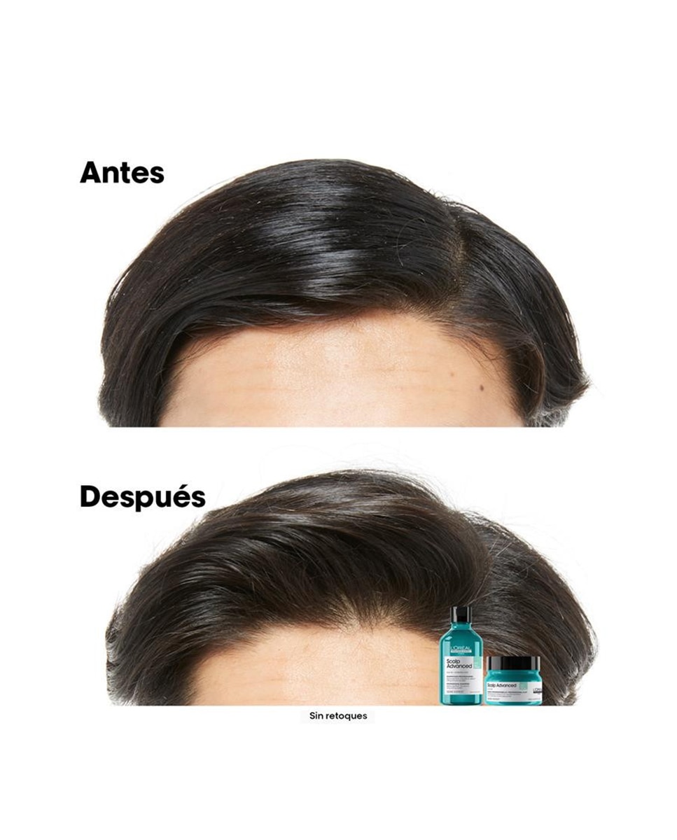 Champú anti grasa enriquecido Pelo graso Scalp Advanced Serie Expert 300 ml L'Oréal Professionnel - 300 ml 4