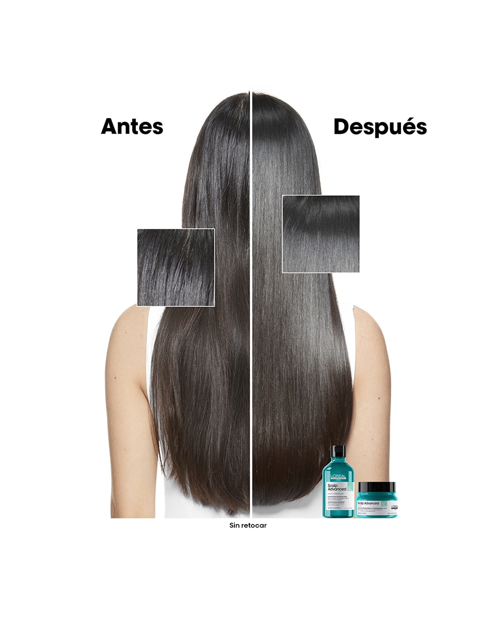 Champú anti grasa enriquecido Pelo graso Scalp Advanced Serie Expert 300 ml L'Oréal Professionnel - 300 ml 5