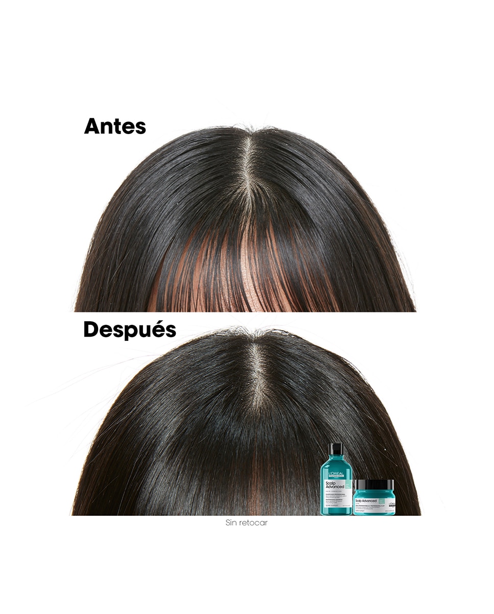 Champú anti grasa enriquecido Pelo graso Scalp Advanced Serie Expert 300 ml L'Oréal Professionnel - 300 ml 6