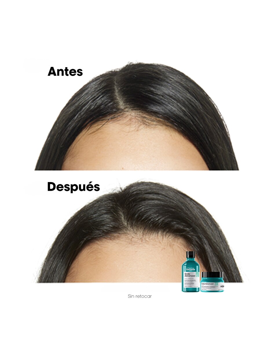 Champú anti grasa enriquecido Pelo graso Scalp Advanced Serie Expert 300 ml L'Oréal Professionnel - 300 ml 7
