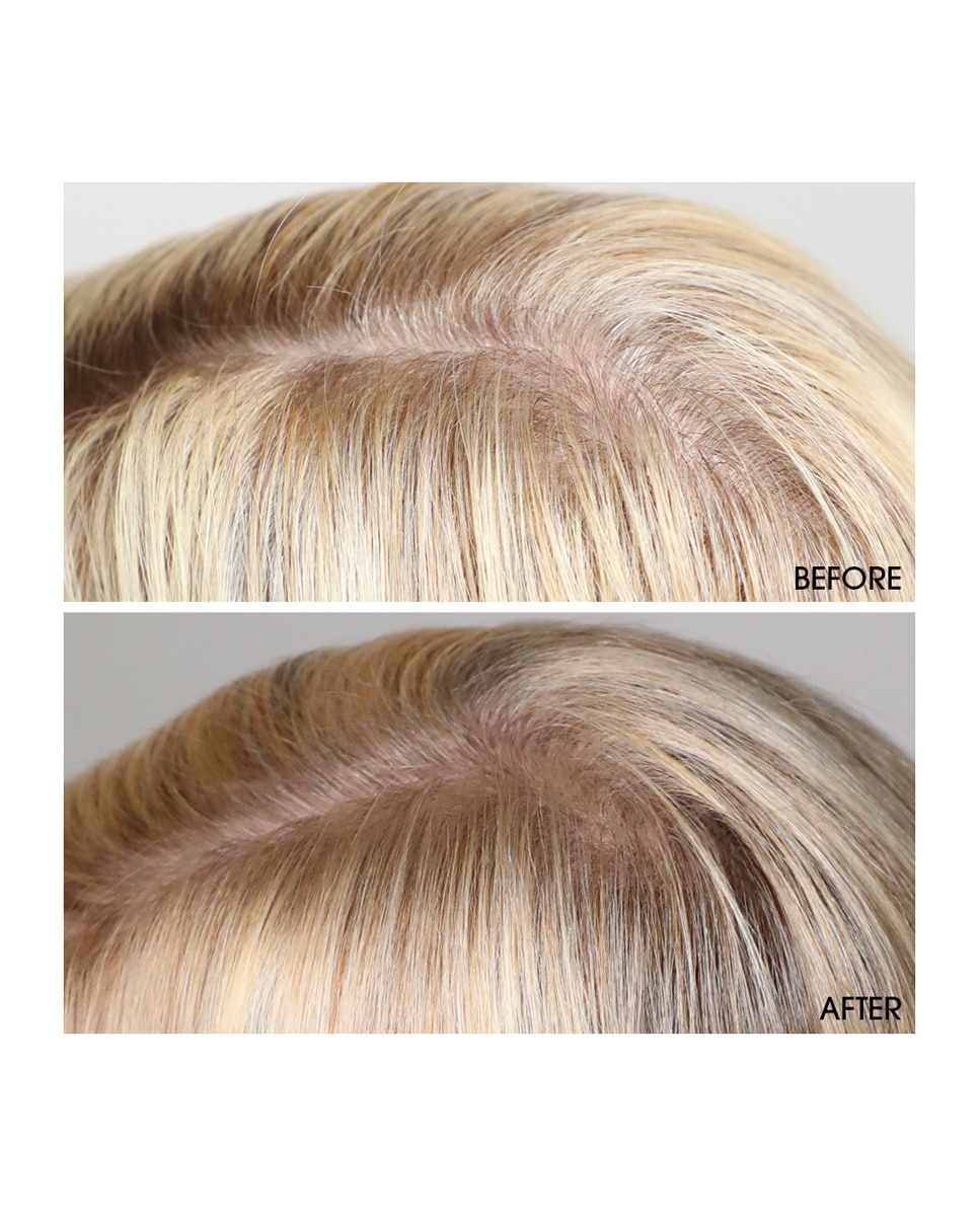 Sérum Activador Crecimiento capilar Hair Activating Serum M2 Beauté - 120 ml 3