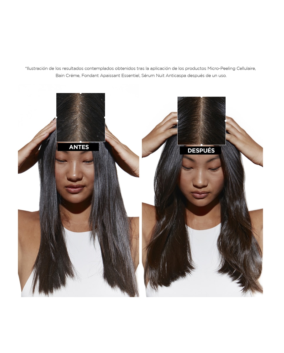 Sérum Nuit Intensif Anticaspa 90 ml Kérastase 5