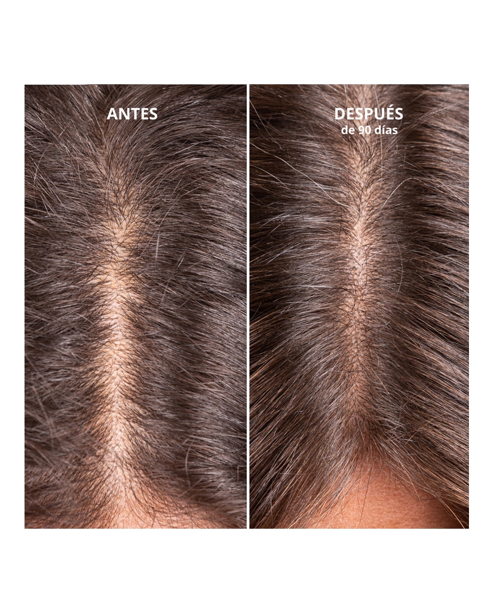 Tratamiento Hair Growth and Density Treatment Freshly Cosmetics - 50 ml 5