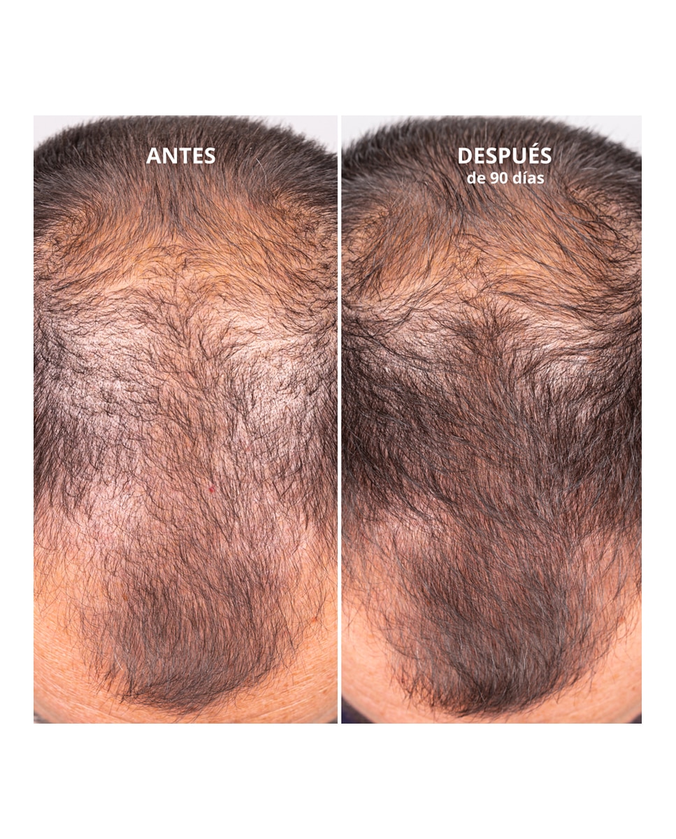 Tratamiento Hair Growth and Density Treatment Freshly Cosmetics - 50 ml 6
