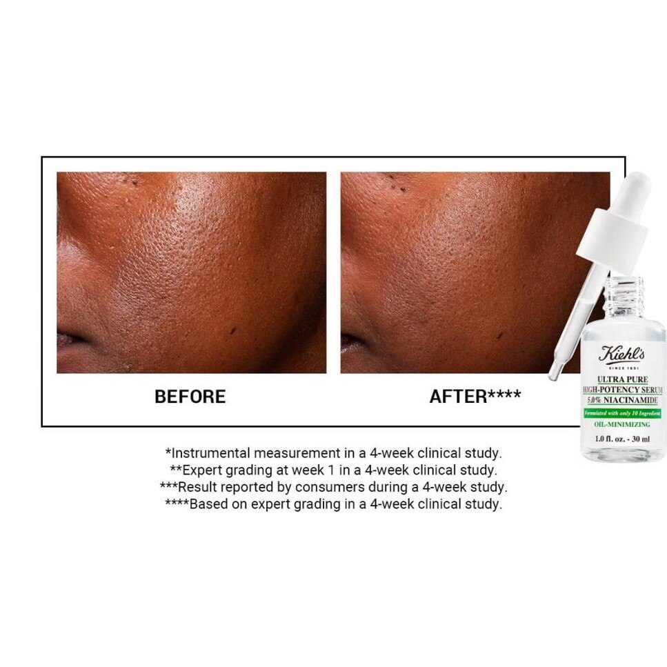 Ultra Pure High-Potency Serum 1.5% Niacinamide Serum - 30 ml 4