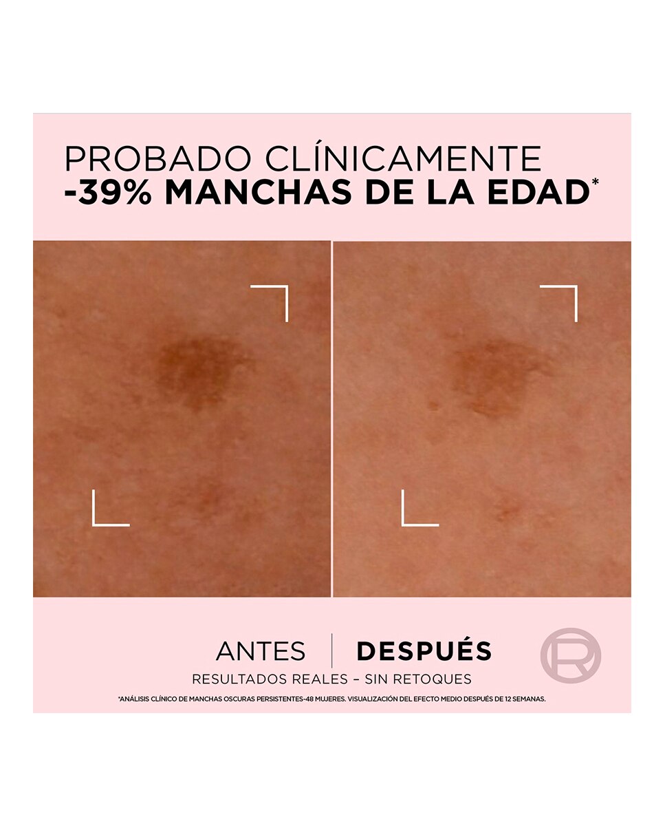 Imagen 4 de Sérum Corrector Age Perfect Acción Rápida Anti-Manchas Pieles Maduras 30 ml L'Oréal Paris - 30 ml