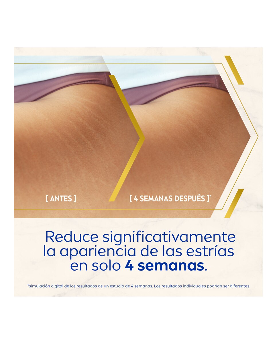 Sérum Corporal Luminous 630 Antiestrías Nivea - 100 ml 4