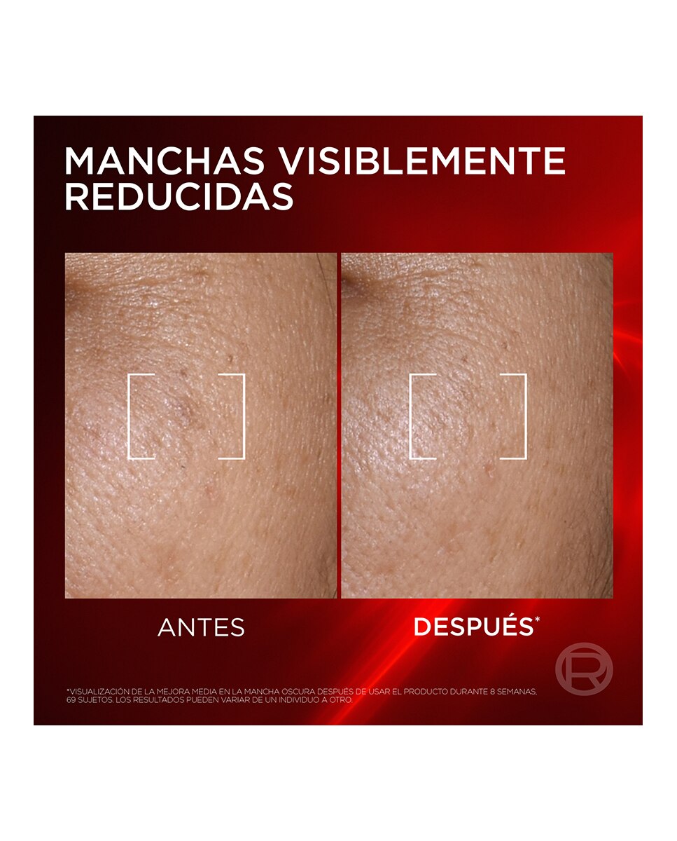 Triple Serum Antiedad Revitalift Laser 30 ml L’Oréal Paris 5