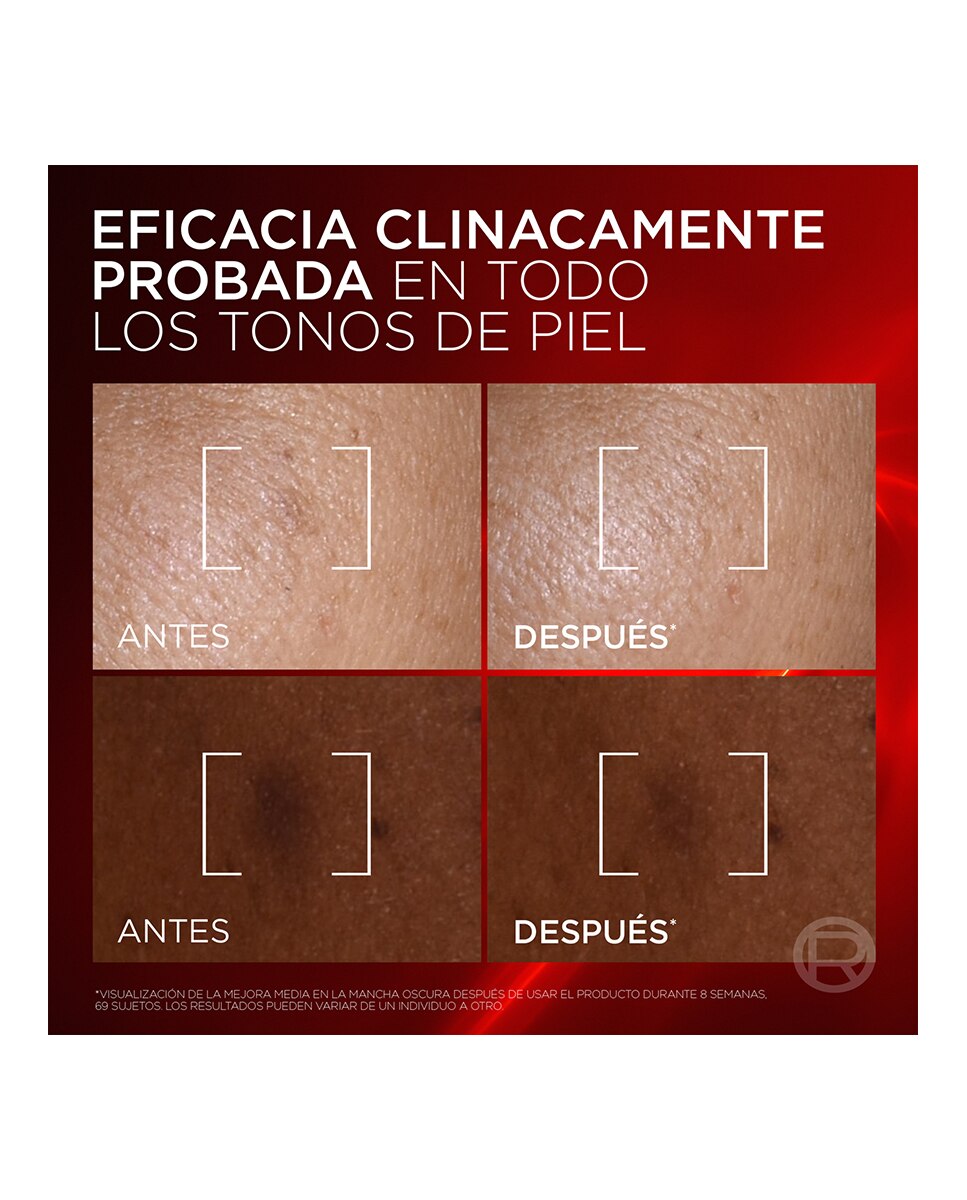 Triple Serum Antiedad Revitalift Laser 30 ml L’Oréal Paris 11