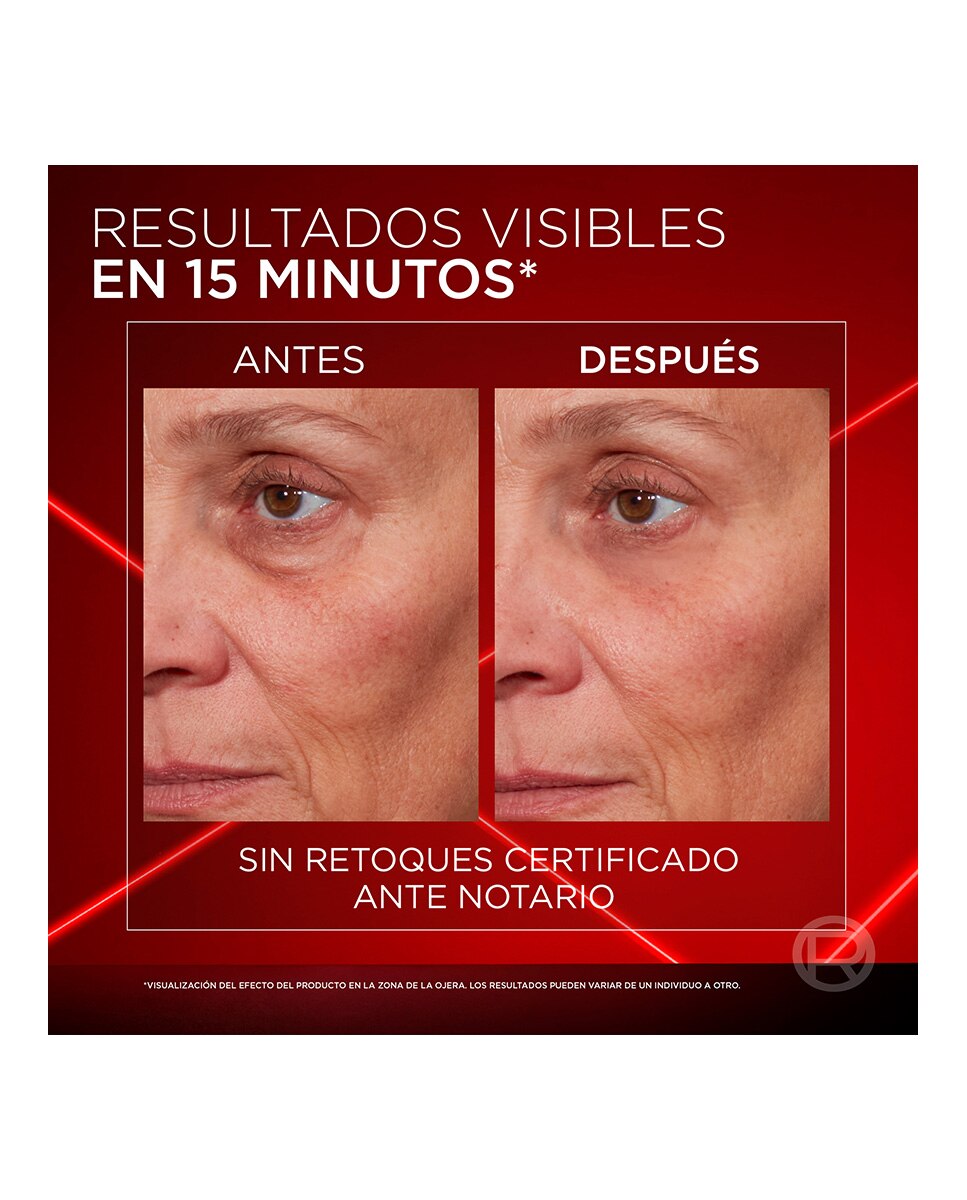 Contorno de Ojos Revitalift Laser Triple Acción L'Oréal Paris - 15 ml 4