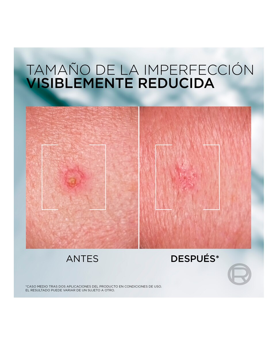 Tratamiento Facial Anti-Imperfecciones Derma Control 45 ml L'oreal Men Expert - 45 ml 5