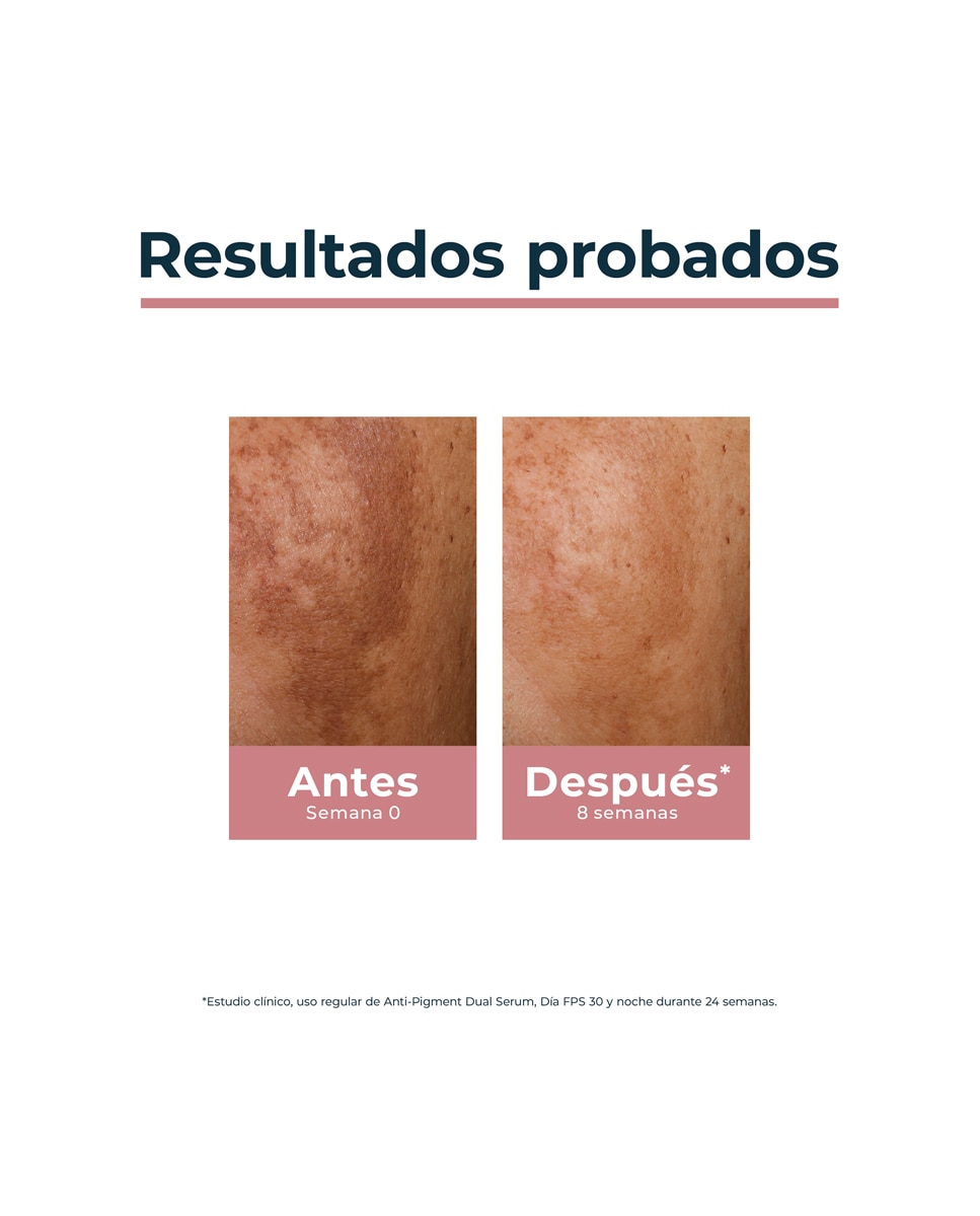 Crema De Dia SPF 30 Anti-Pigment Eucerin - 50 ml 6