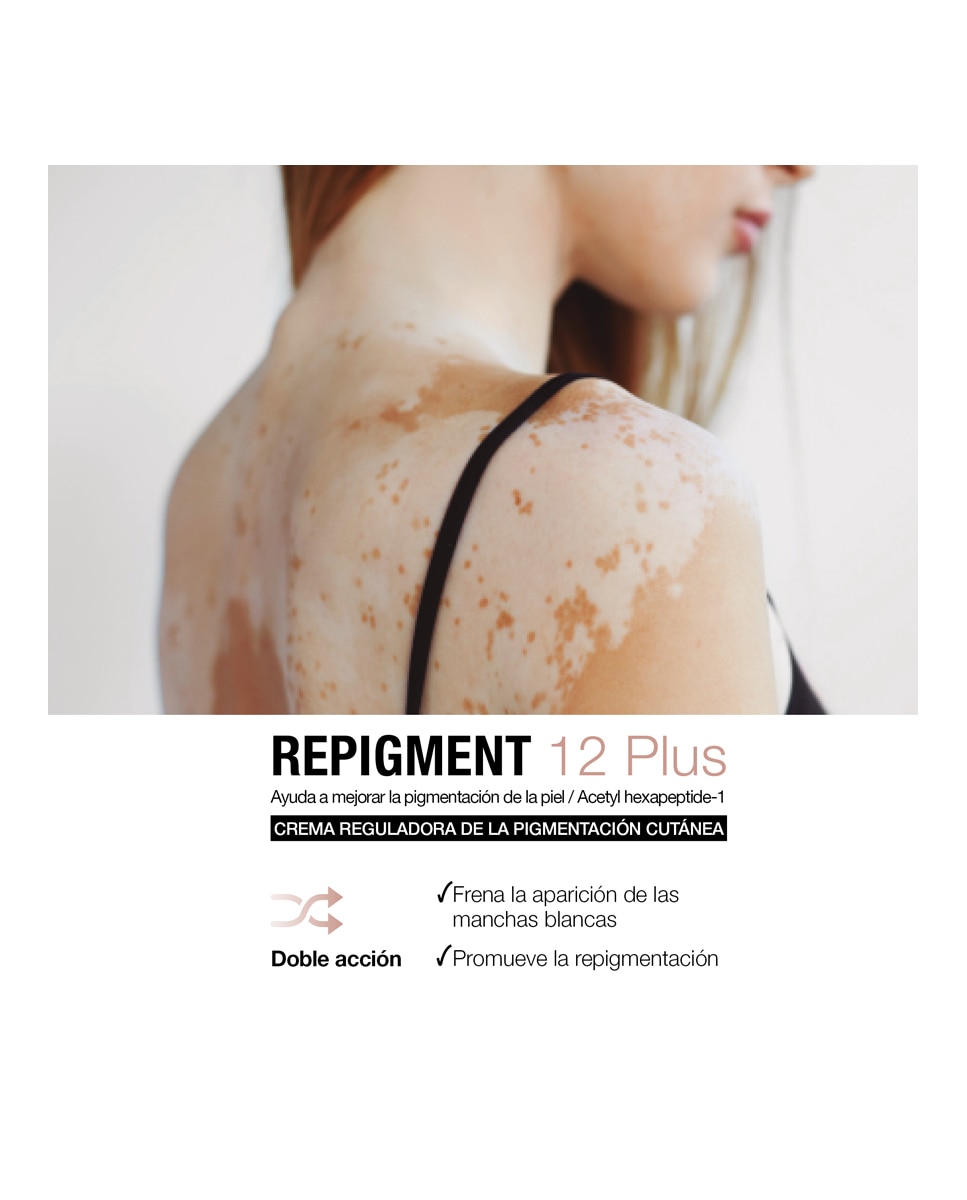 Crema Repigmentante Repigment12 Plus Bella Aurora 3