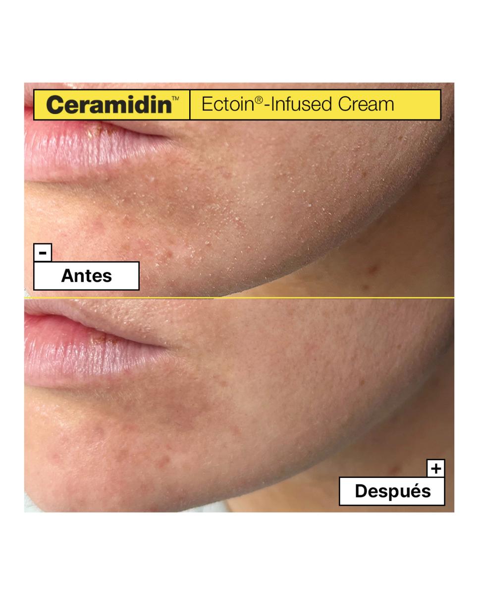 Imagen 3 de Ceramidin Crema con ectoína 50ml Dr Jart - 50 ml