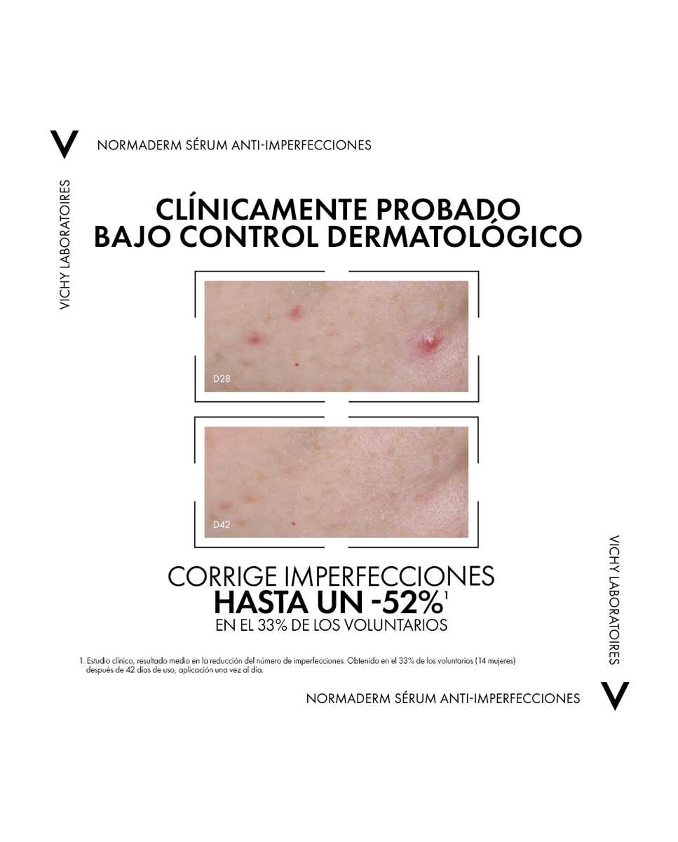 Imagen 5 de Sérum Probio-BHA Anti-Imperfecciones Normaderm 30 ml Vichy Laboratoires - 30 ml