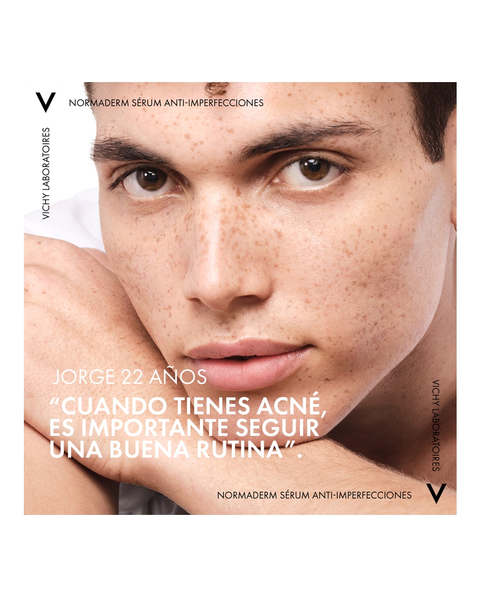 Imagen 17 de Sérum Probio-BHA Anti-Imperfecciones Normaderm 30 ml Vichy Laboratoires - 30 ml
