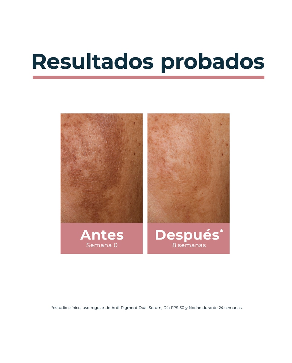 Serum Dual Anti-Pigment Eucerin - 30 ml 6