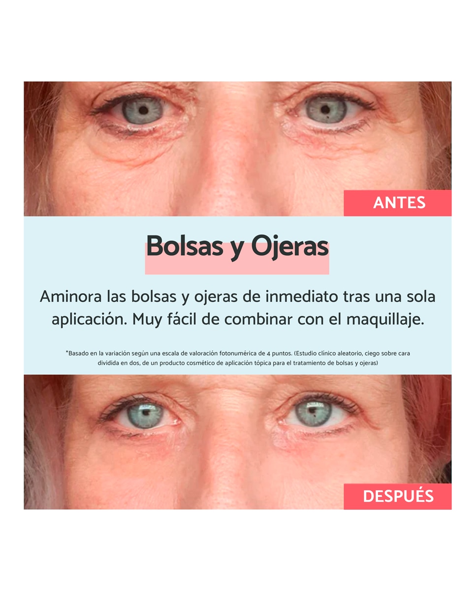 Contorno de Ojos Bolsas Y Ojeras Vegetal Remescar - 8 ml 4