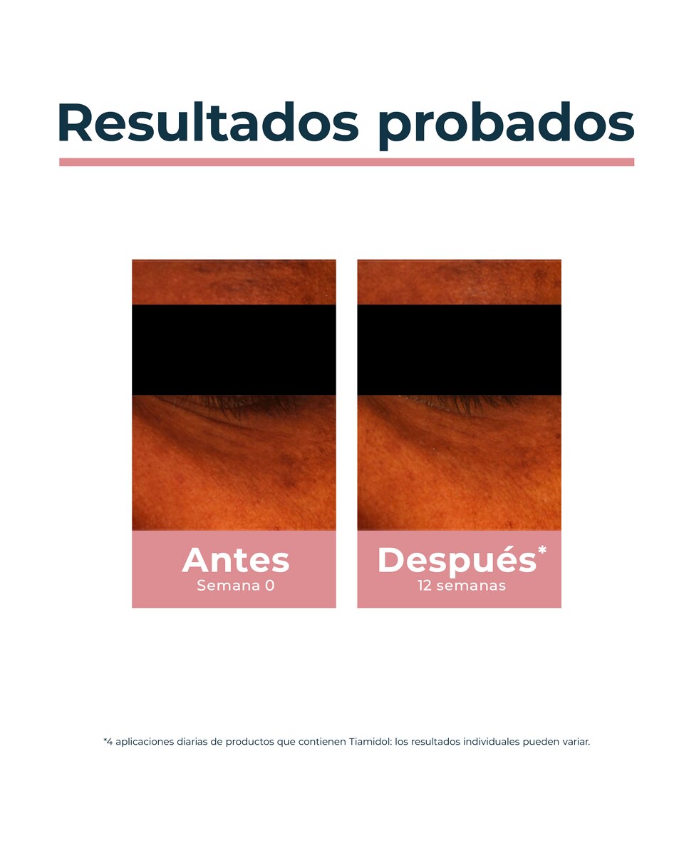 Contorno de ojos Anti-Pigment 15 ml Eucerin 6
