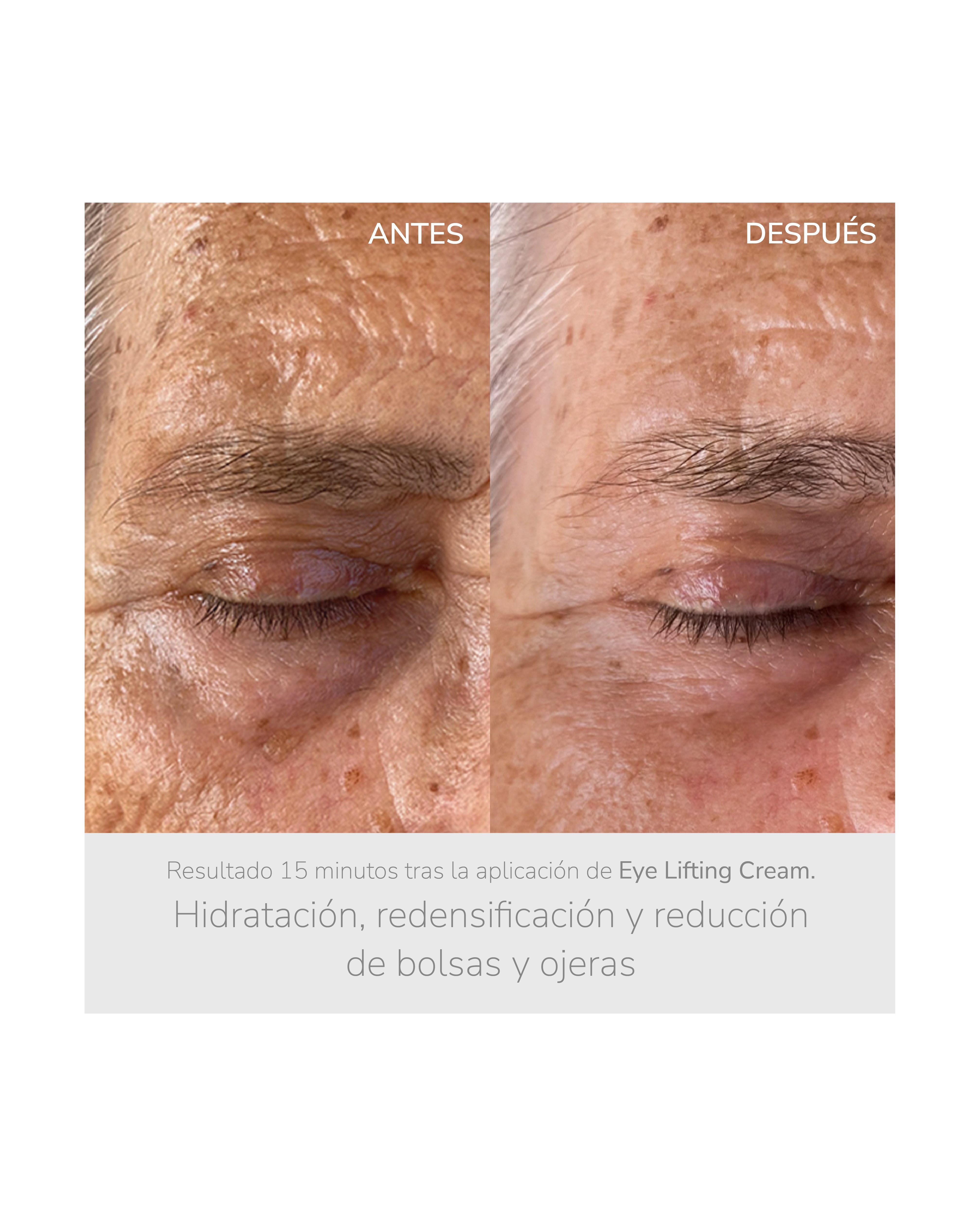 Contorno de ojos reafirmante Eye Lifting Cream 15ml NIEVES by Nieves Álvarez - 15 ml 5