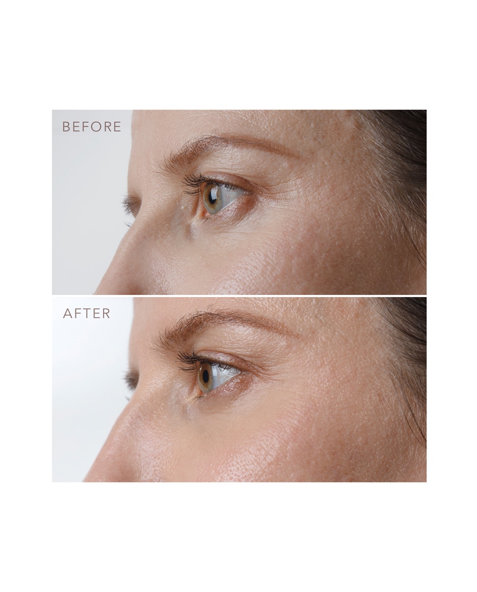 FOREO IRIS™ PM Sérum reafirmante para el contorno de ojos con infusión de retinol y extracto de hongos FOREO - 15 ml 5