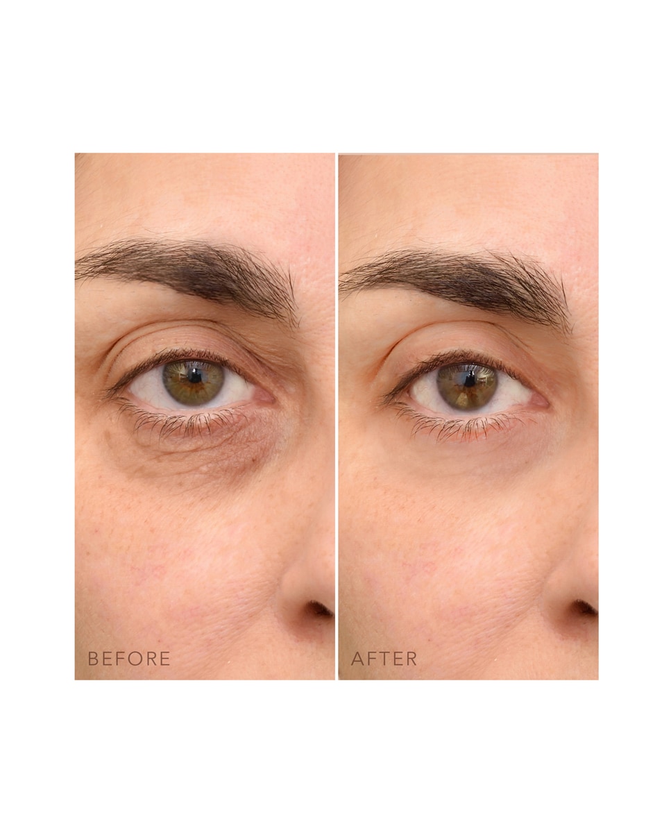 IRIS™ C-Concentrated Crema Iluminadora de Ojos FOREO - 15 ml 5