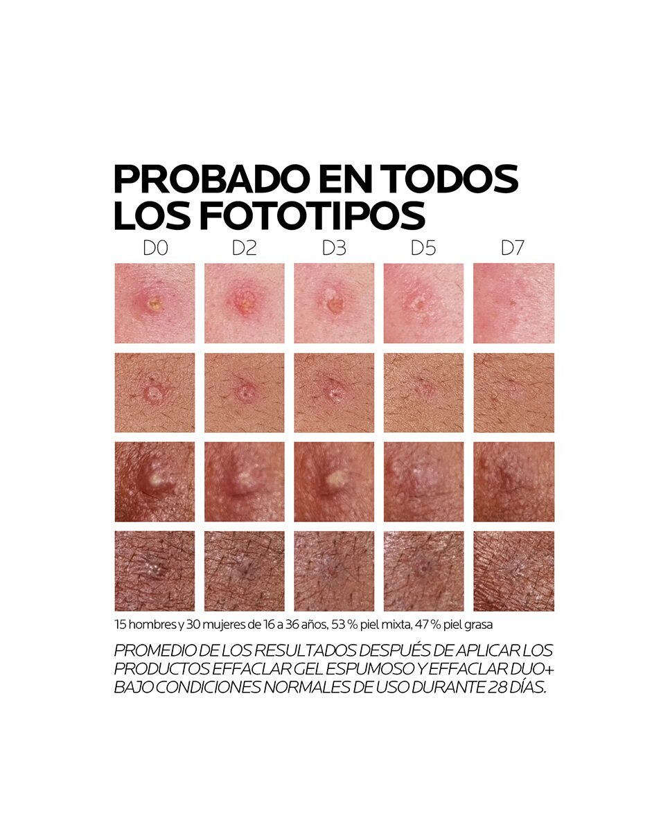 Tratamiento Anti-imperfecciones y Marcas Effaclar Duo (+) La Roche Posay - 40 ml 4
