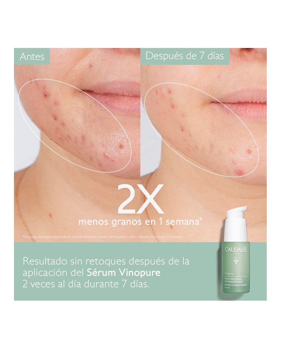 Sérum Anti-imperfecciones Vinopure Caudalie - 30 ml 2