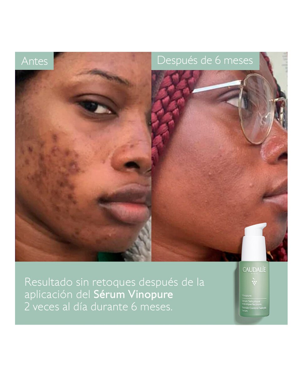 Sérum Anti-imperfecciones Vinopure Caudalie - 30 ml 5