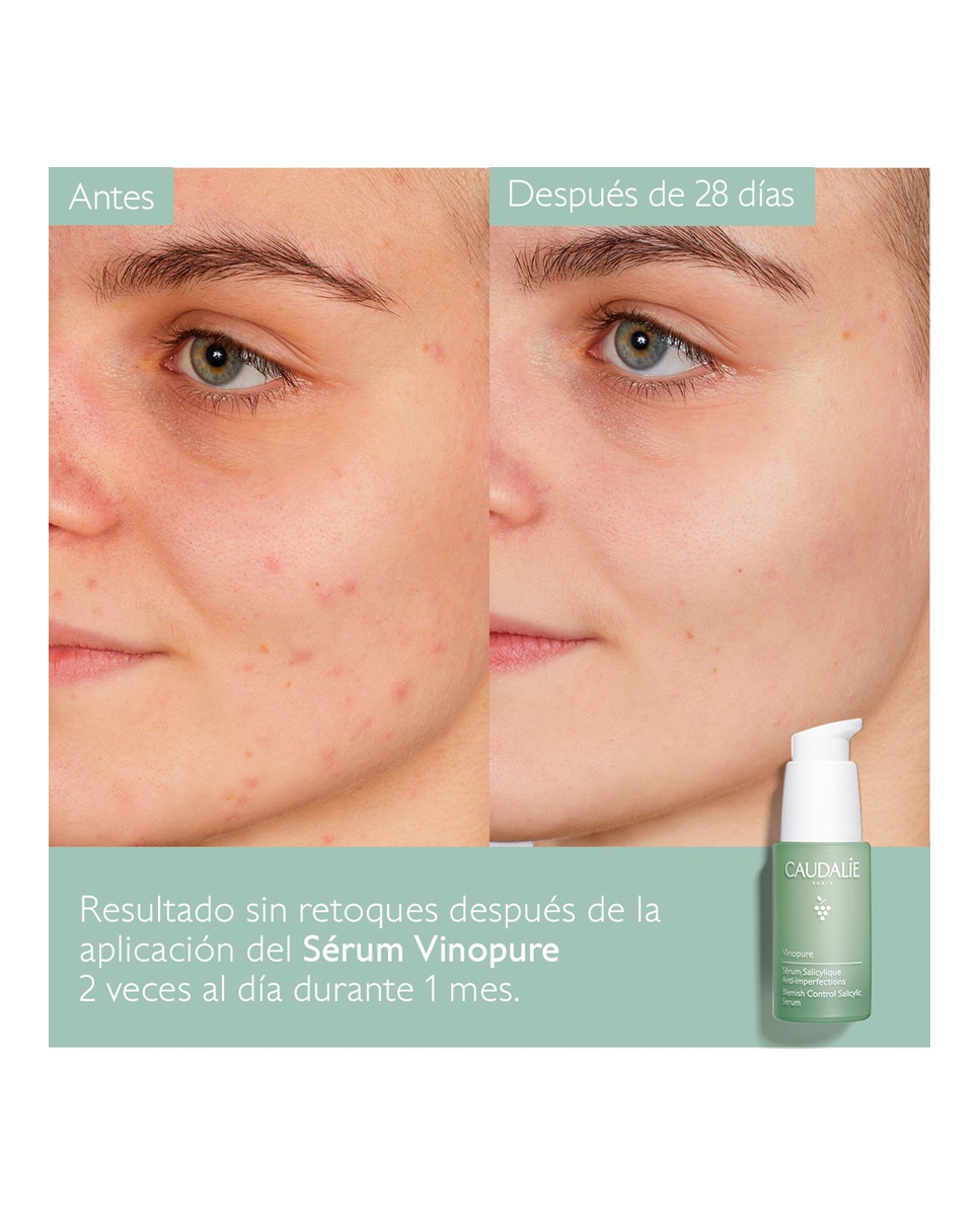 Sérum Anti-imperfecciones Vinopure Caudalie - 30 ml 8