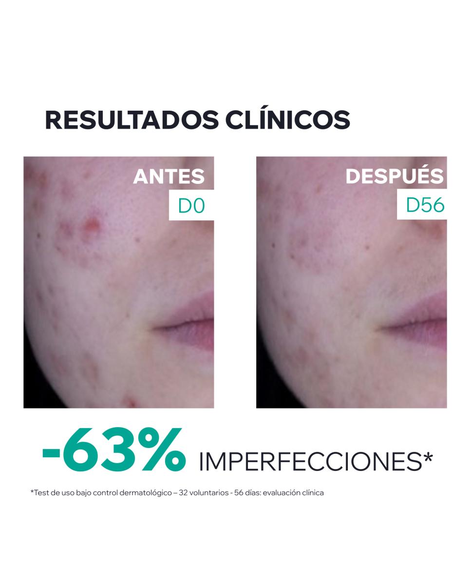 Cuidado Global Anti-Imperfecciones 3- Regul+ Hyseac 40 Ml Uriage - 40 ml 7