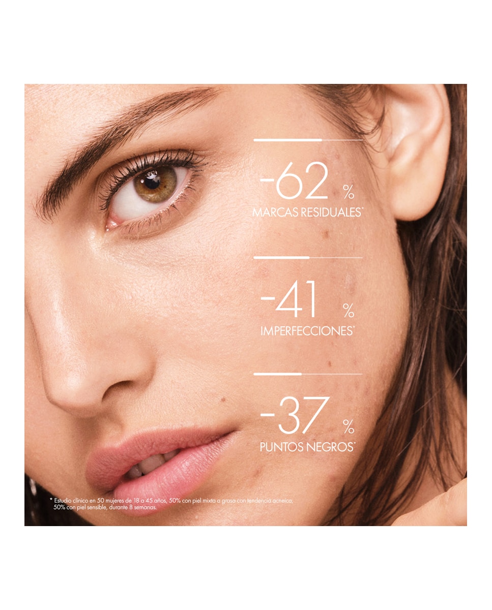 Imagen 3 de Tratamiento Doble Corrección Ácido Salicílico Normaderm Phytosolution 50 ml Vichy - 50 ml