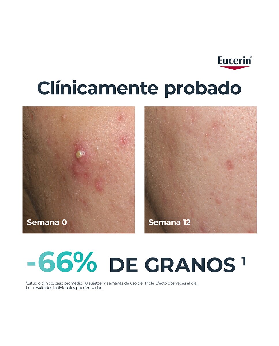 Sérum Triple Efecto DermoPure Oil Control 40 ml Eucerin - 40 ml 3