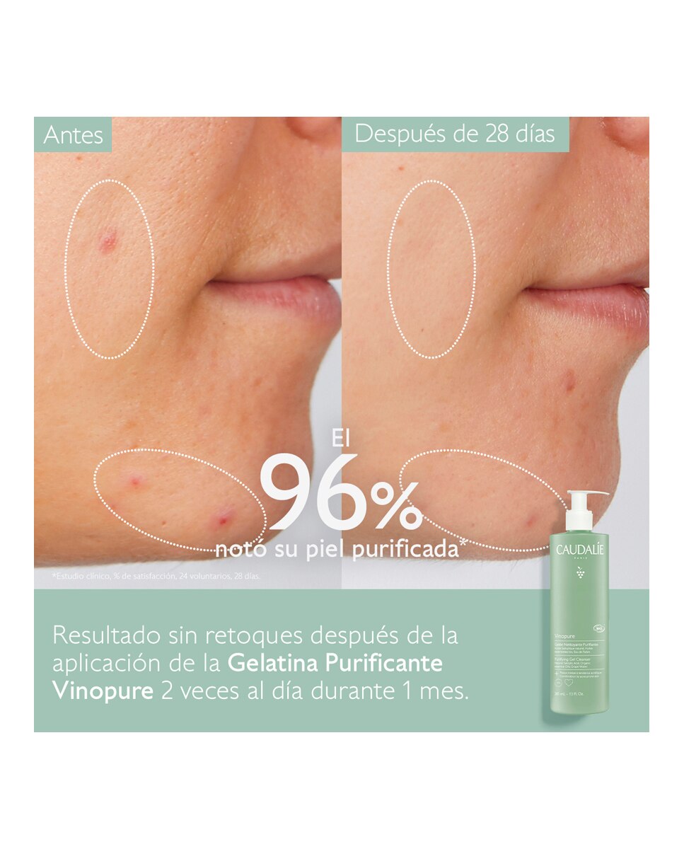 Gelatina Limpiadora Purificante Vinopure Caudalie - 385 ml 5