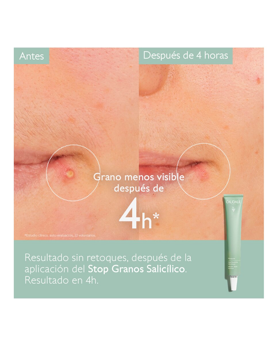 Stop Granos Salicílico Vinopure Caudalie - 15 ml 2