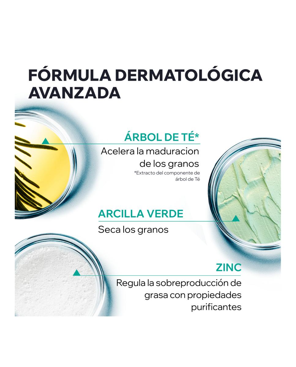 Pasta SOS Tratamiento Localizado Hyseac 15g Uriage - 15 g 5