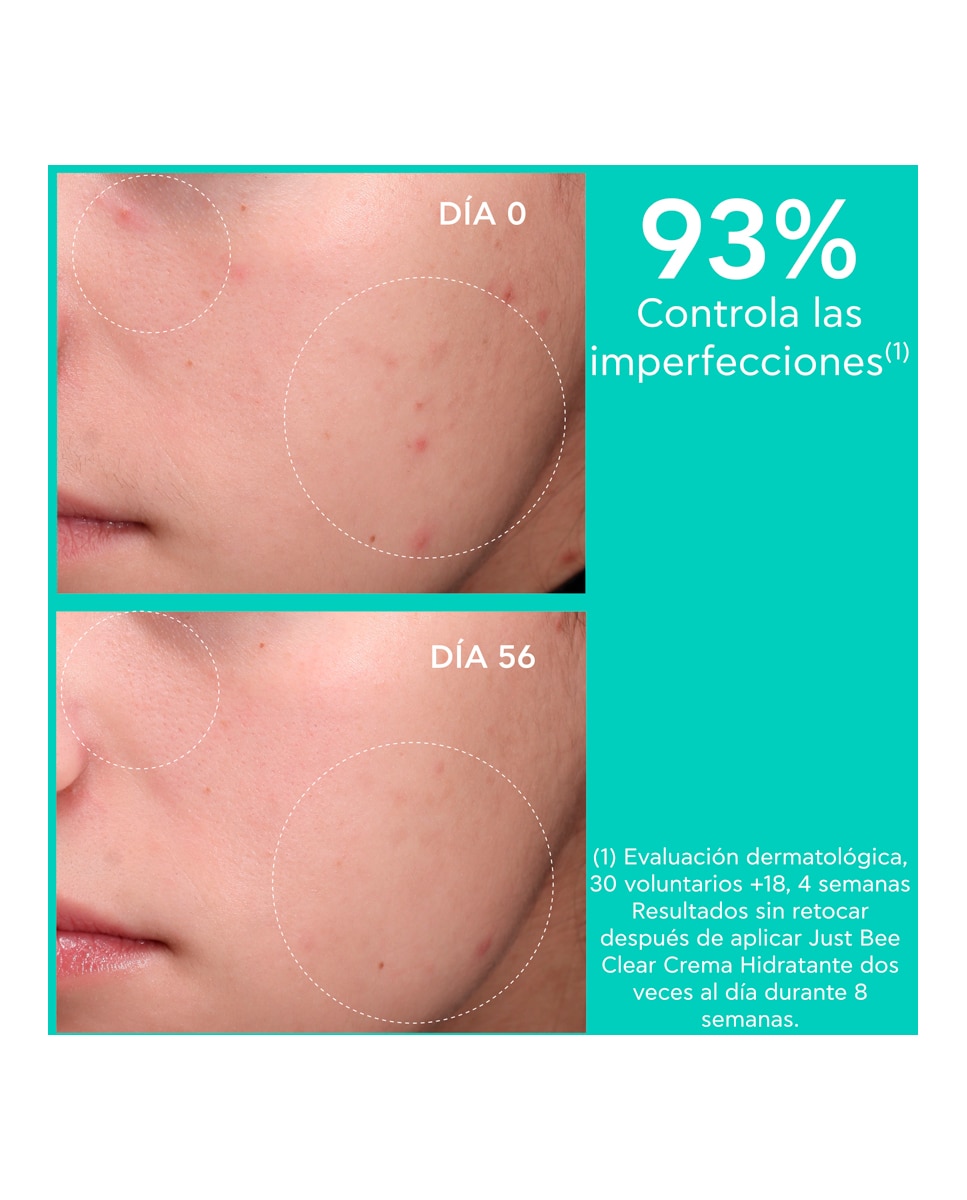 Crema Anti-Imperfecciones Just Bee Clear 40 ml Apivita - 40 ml 5