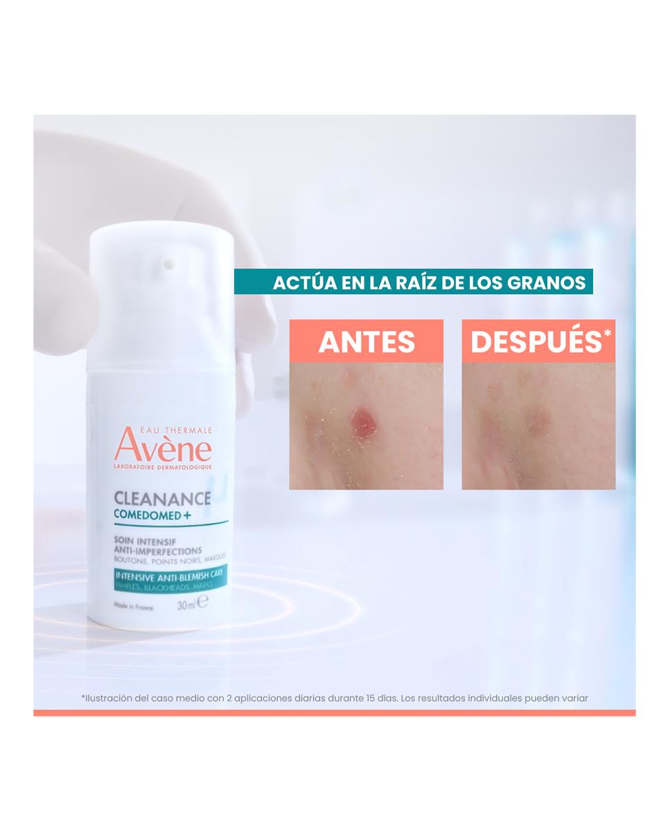 Cleanance Comedomed Concentrado Anti-imperfecciones Avène - 30 ml 5