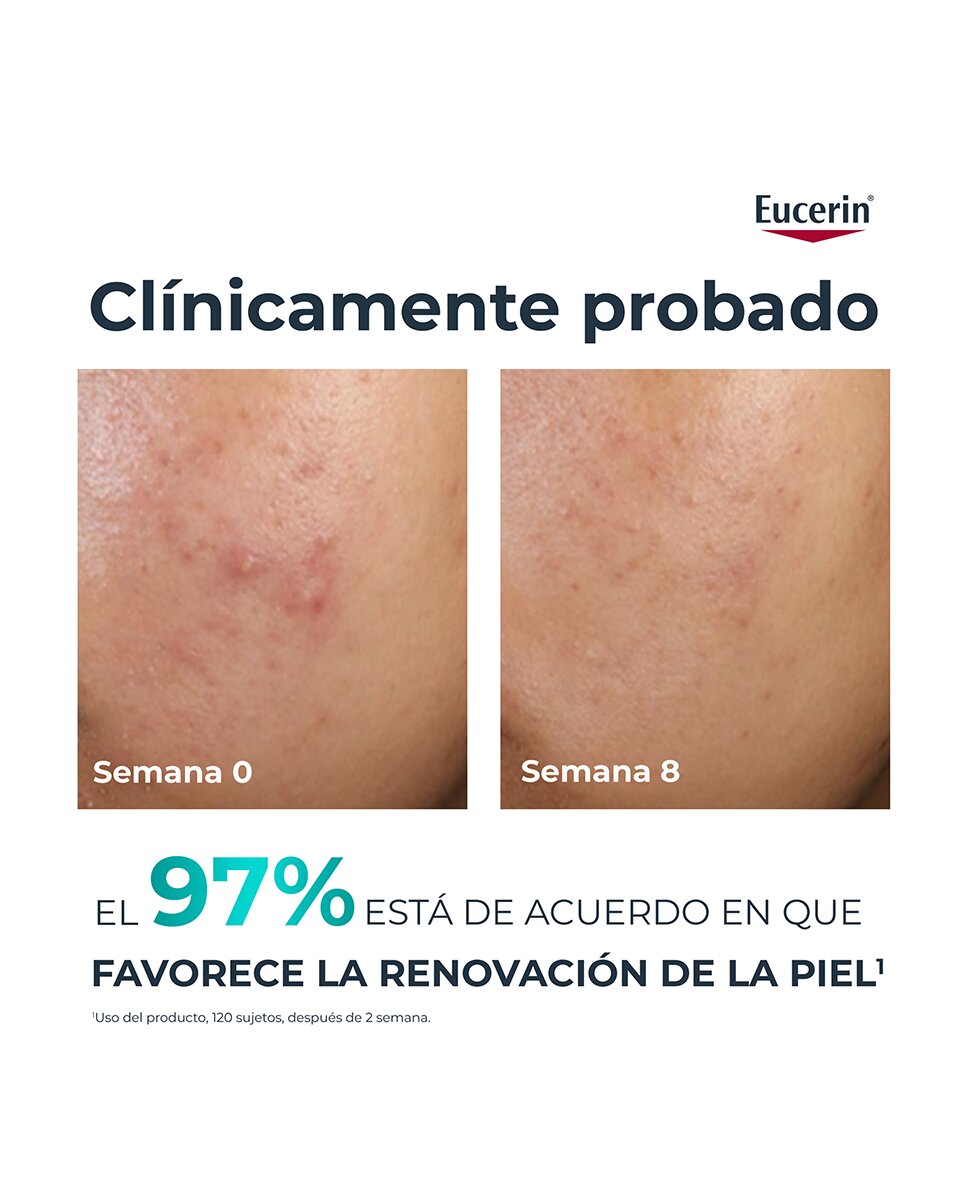 Peeling Facial 10 DermoPure Clinical 40 ml Eucerin - 40 ml 3