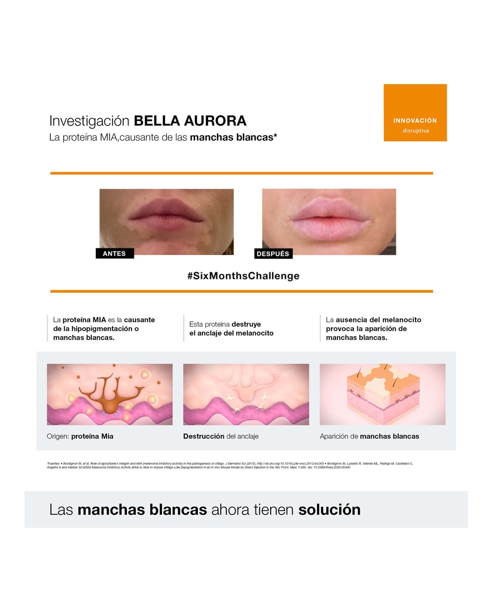 Crema Repigment12 75 ml Bella Aurora - 75 ml 4