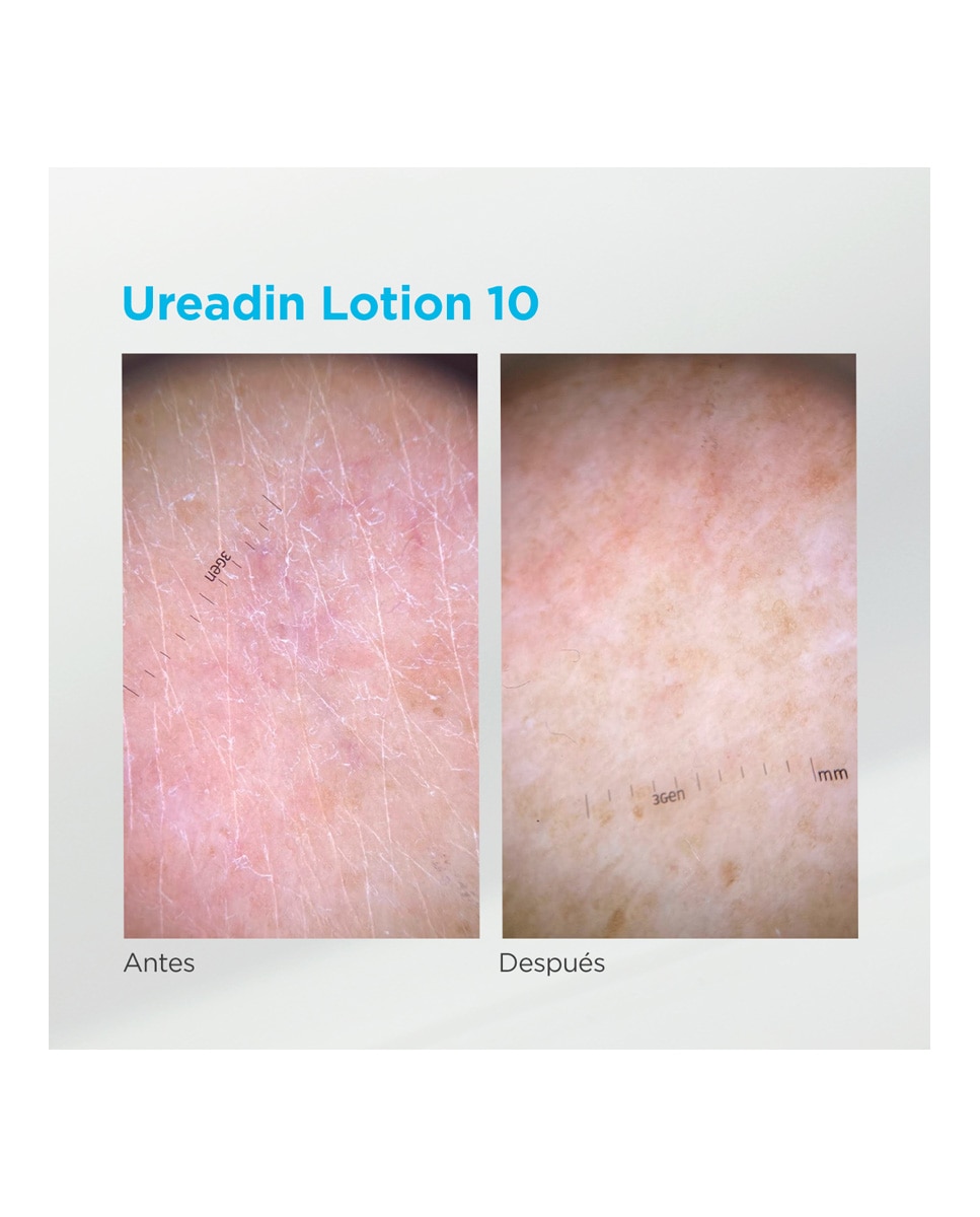 Lotion Hidratación Intensa Piel seca Ureadin 10 Isdin - 1000 ml 2