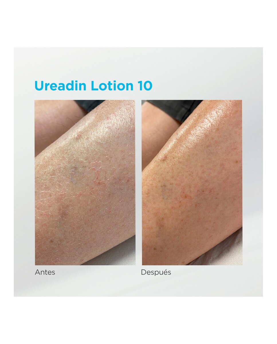 Lotion Hidratación Intensa Piel seca Ureadin 10 Isdin - 1000 ml 3