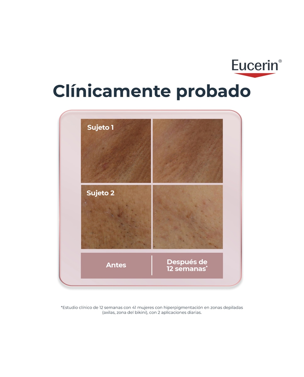 Anti-pigment Serum Corporal Áreas Sensibles 75ml 6