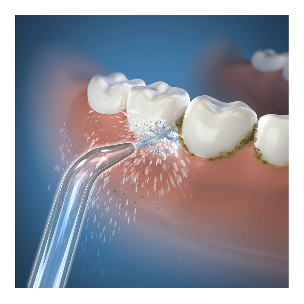 Recambios Boquilla estándard Irrigador dental WP70 Waterpik 2