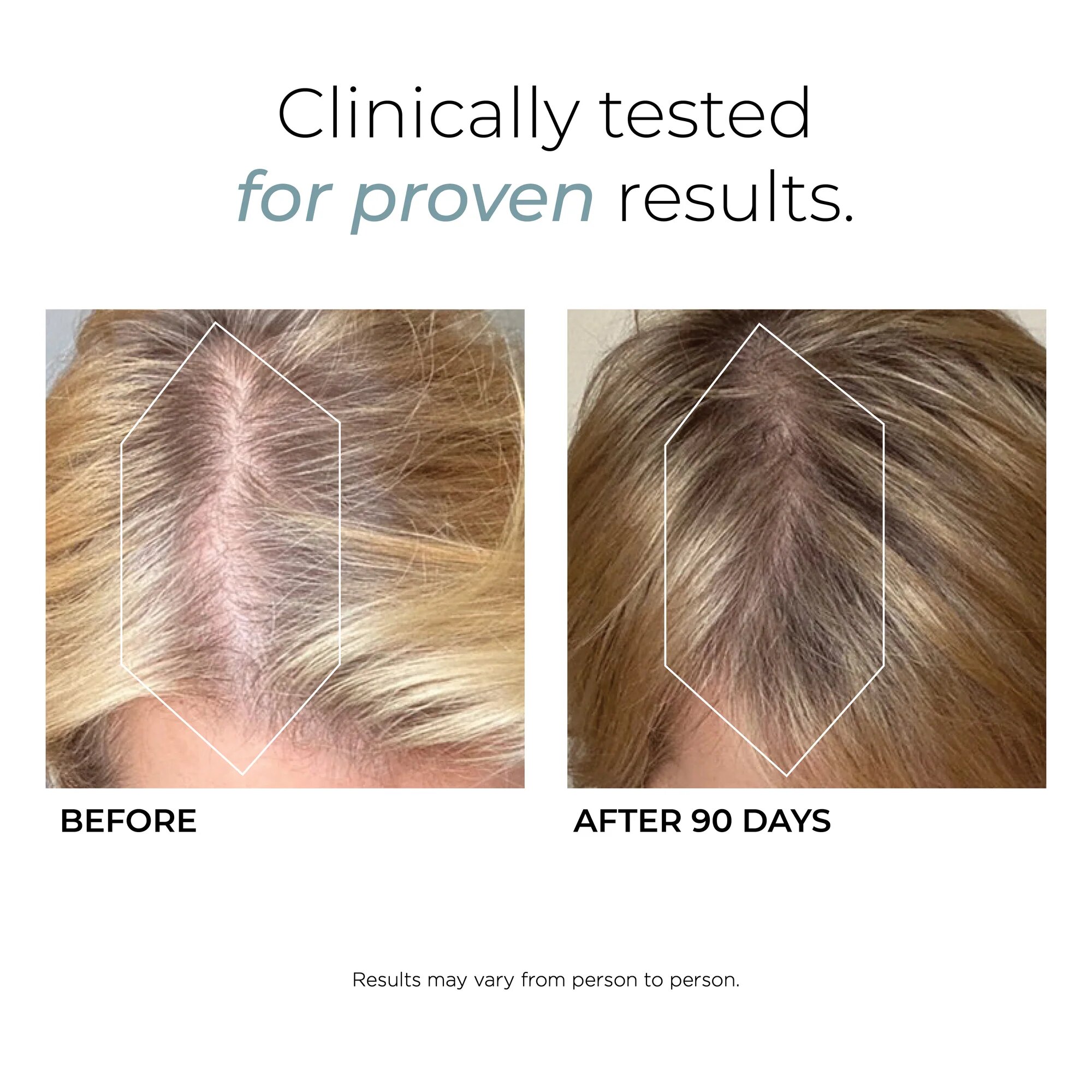 120 Cápsulas Deeply Rooted Fórmula Anticaída Capilar Hush&Hush 4