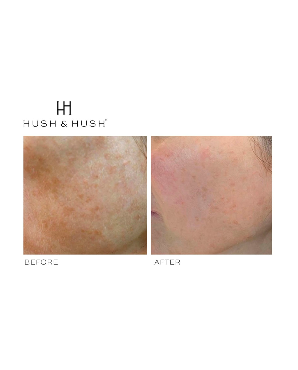 60 Cápsulas SkinCapsule Brighten+ Fórmula Antiacné Hush&Hush - 60 Cápsulas 3