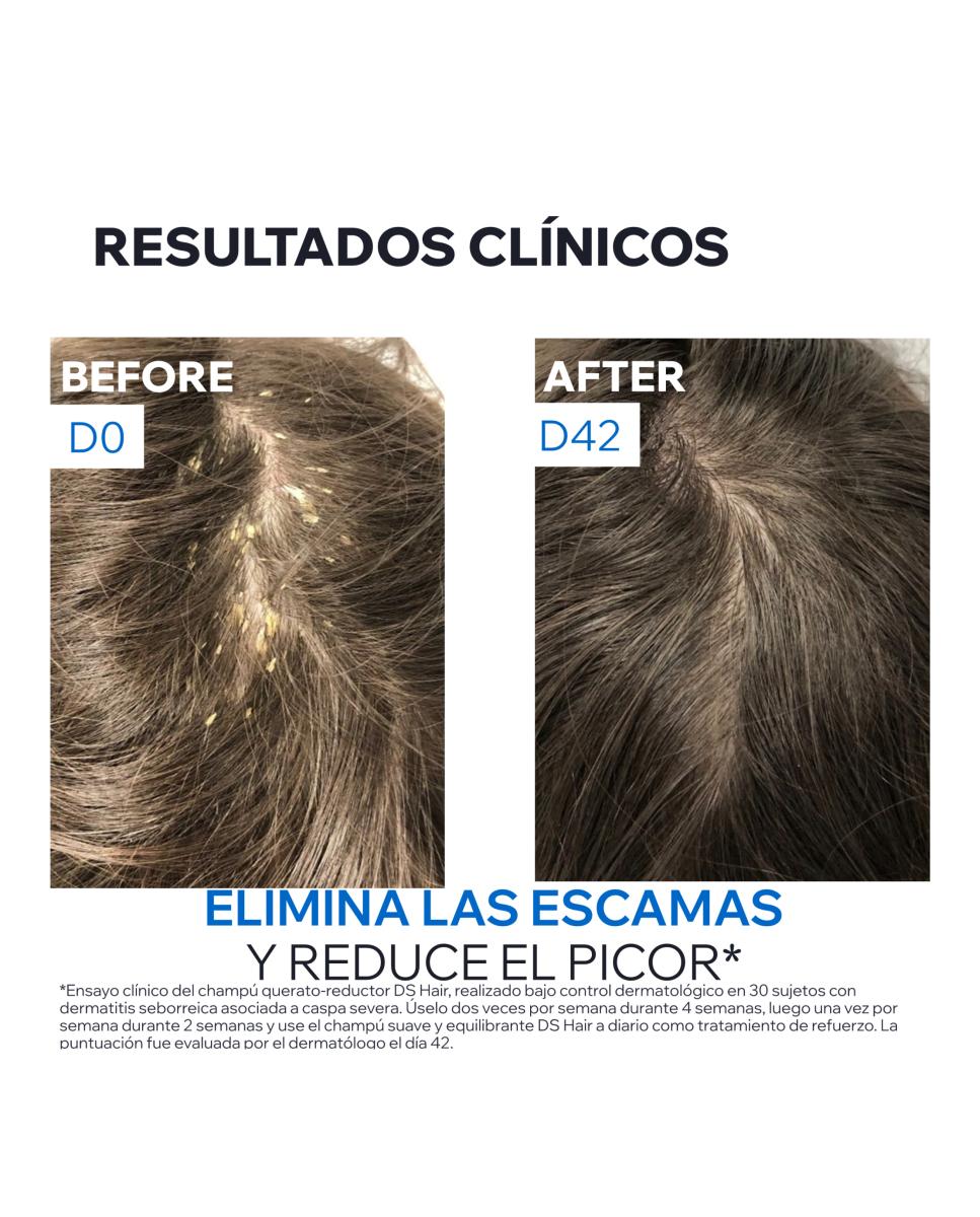 Hair Champú de Tratamiento Queratorreductor HS Uriage - 150 ml 7